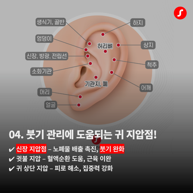 정관보청기 귀건강 5.png